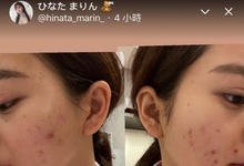 不化妆不行！ひなたまりん的脸坏掉了！-沐风文化